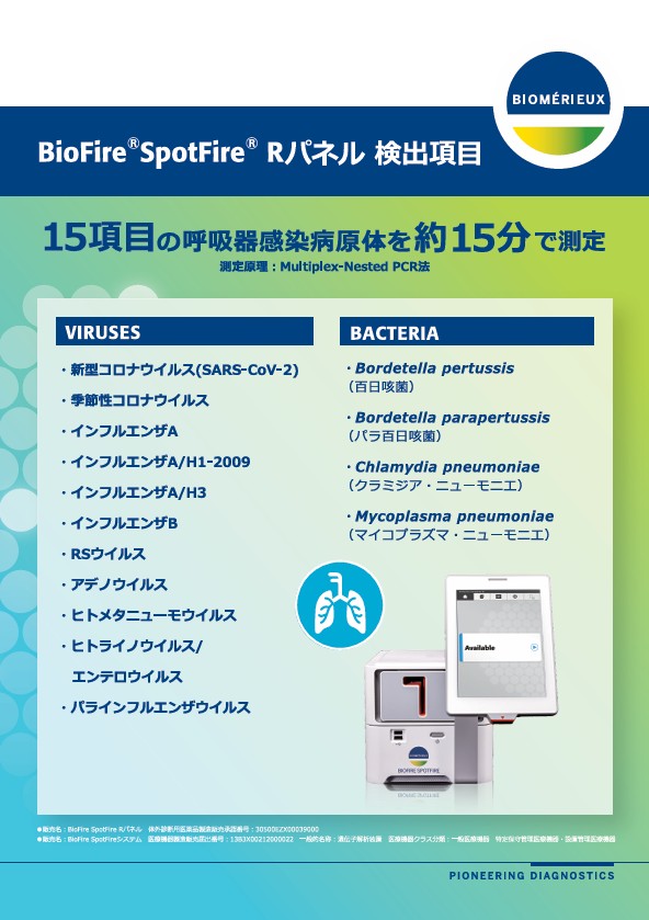 SpotFire検査項目